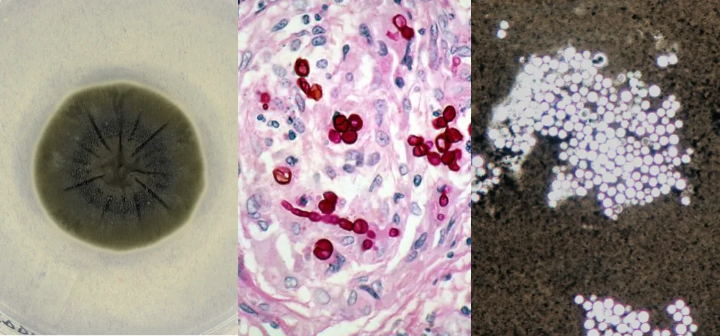 Cellular images of three melanized fungi